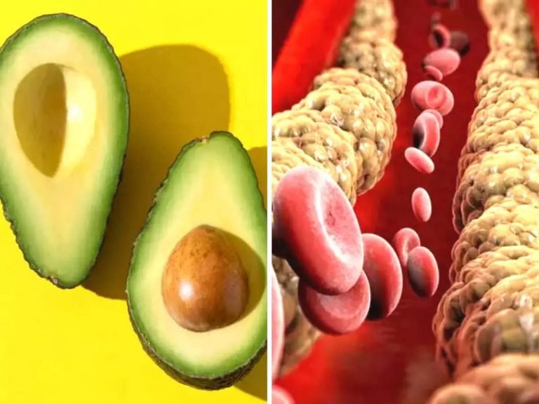 avocado benefits cholesterol, Avocado Benefits: वैज्ञानिकों का दावा हर दिन एक एवोकाडो खाने से कम होगा खून में जमा Bad cholesterol – american heart association published research says eating avocado daily can help lower cholesterol