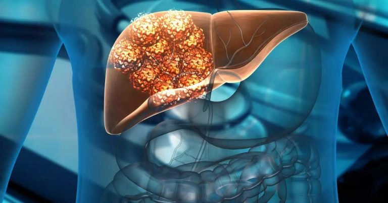 Bad Habits for liver: शराब ही नहीं आपकी ये 7 गंदी आदतें भी सड़ा सकती हैं लीवर, तुरंत बदल डालें – studies show unhealthy habits can cause liver cirrhosis equal damage to liver as alcohol does