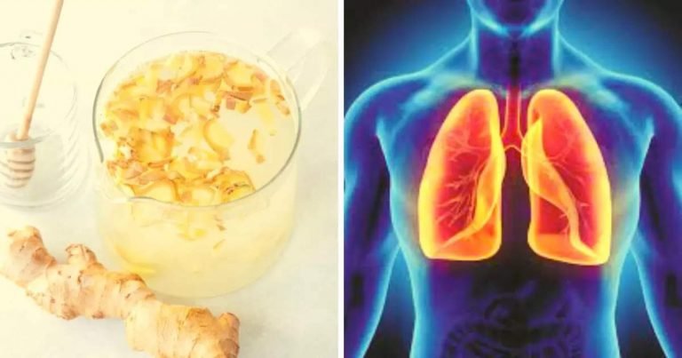 World Lung Cancer Day: सांस की तकलीफ-जकड़न फेफड़ों में गंदगी के हैं संकेत, इन 5 तरीकों से बनाए लंग्स को नया – world lung cancer 2022 ayurveda doctor shared 5 natural tips to cure breathing problem and diseases