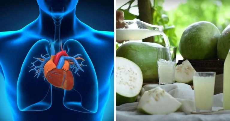 Ash gourd benefits: 40 रुपए का ये फ्रूट दिल-दिमाग फेफड़े और गुर्दे करता है मजबूत, तुरंत शुरू कर दें सेवन – ayurveda doctor mihir khatri shared health benefits and way to use of petha or ash gourd