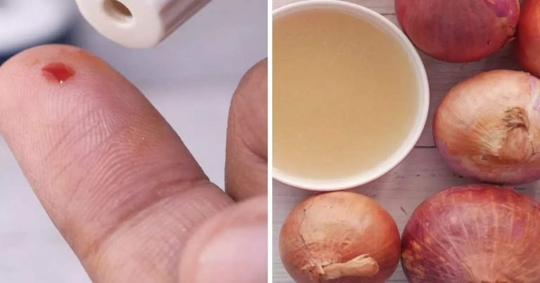 Diabetes tips: डायबिटीज के मरीजों के लिए टॉनिक है प्याज का पानी, तेजी से कम होगा Blood Sugar, जानिए विधि – according to celebrity nutritionist diabetics drink onion water to control blood medicine without medicine