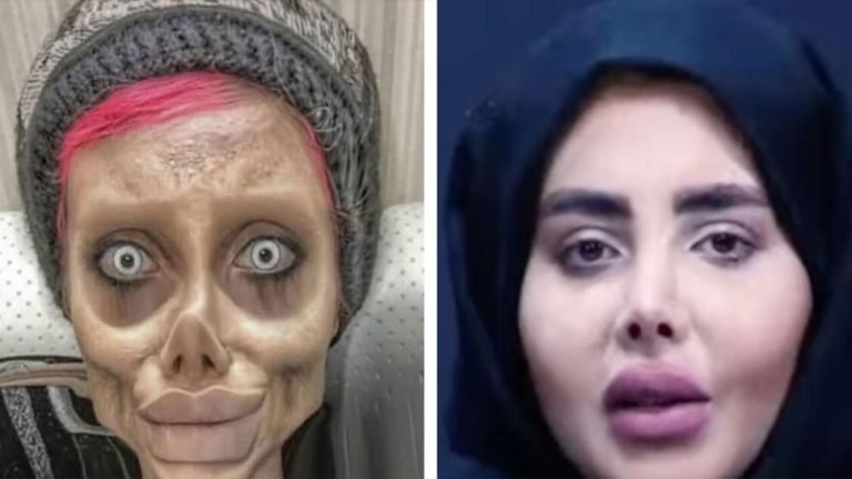 Iran Zombie Angelina Jolie News the real face surfaced for the first time | Zombie Angelina Jolie: ऐसी दिखती हैं ईरान की जॉम्बी एंजलिना जोली, पहली बार असली चेहरा आया सामने
