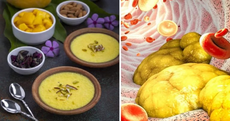 Diwali Celebration में एक गलती भी बढ़ा सकती है खराब कोलेस्ट्रॉल, डॉ. से जानें क्या करें और क्या नहीं? – according to senior doctor one mistake in diwali celebration can increase bad cholesterol know what to do or not to do