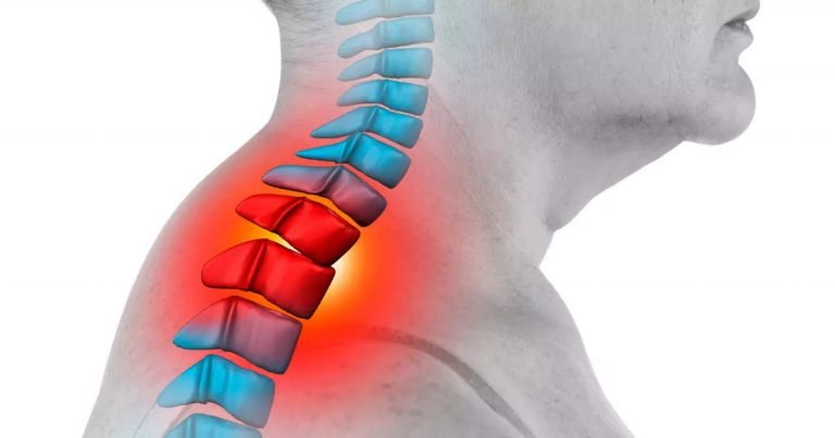 Exercise for Neck: सिर घुमाने पर आते हैं चक्कर? तो शुरू हो गया सर्वाइकल, रुटीन में शामिल करें 2 एक्सरसाइज – neck exercise to treat cervical pain and strengthening muscles see video