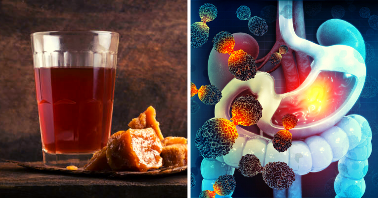 Jaggery Benefits: खाली पेट पानी में मिलाकर पिएं गुड़, एक्सपर्ट ने बताया डिटॉक्स समेत बॉडी को मिलते हैं 5 फायदे – yoga coach avni talsania shared benefits of jaggery drink having in empty stomach