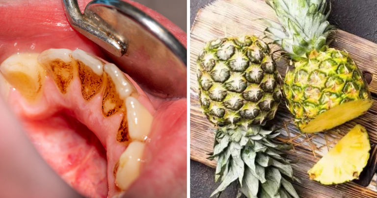 teeth whitening treatment, Teeth Whitening: दिन-रात ब्रश घिसकर भी दांत नहीं हो रहे साफ? ये 6 फल खाने से उतर जाएगी दांतों की पीली परत – how to whiten your teeth naturally add these 6 fruits in your diet to make your yellow teeth white