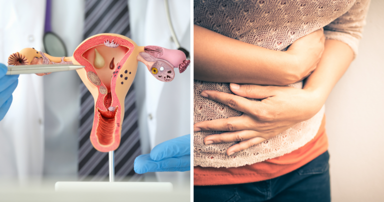 Ovarian Cancer Symptoms in Hindi, कुछ टुकड़े खाते ही भर जाता है पेट तो हो चुका है ये कैंसर, बन जाती है रसौली-गांठ, 5 लक्षण हैं खतरनाक – ovarian cancer symptoms and signs in hindi that every woman should know