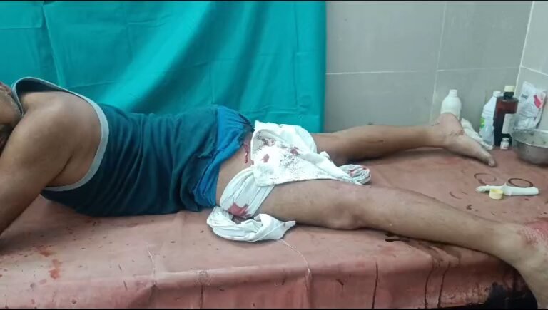 चलती ट्रेन में रेलकर्मी से चाकूबाजी