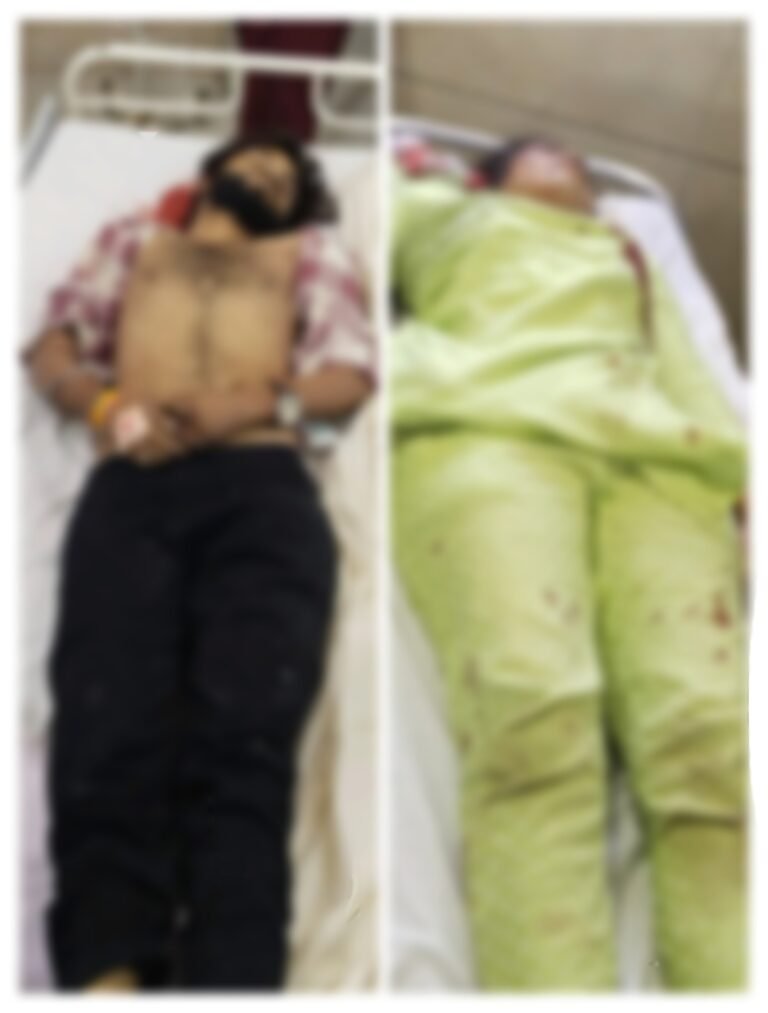 इंदौर में सिरफिरे युवक ने पिस्तौल से युवती और युवक को मौत के घाट उतार कर स्वयं कर ली आत्महत्या।