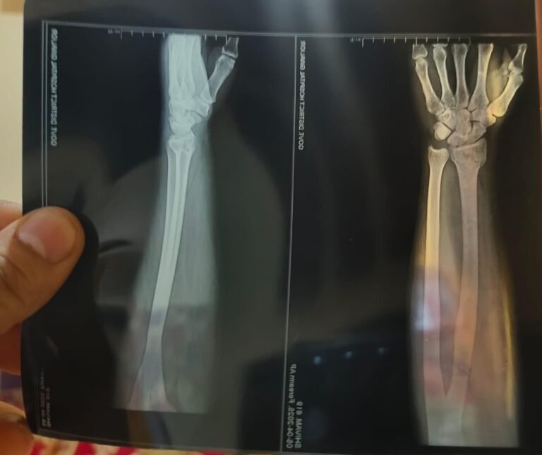 भिंड मे खोया व्यापारी के साथ हुई मारपीट।