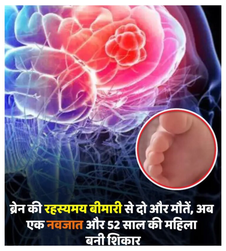 केरल में अमीबिक मेनिंगोएन्सेफलाइटिस से दो और मौतें, अगस्त में मरने वालों की संख्या तीन हुई