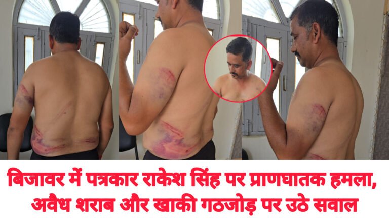 बिजावर में पत्रकार राकेश सिंह पर प्राणघातक हमला, अवैध शराब और खाकी गठजोड़ पर उठे सवाल