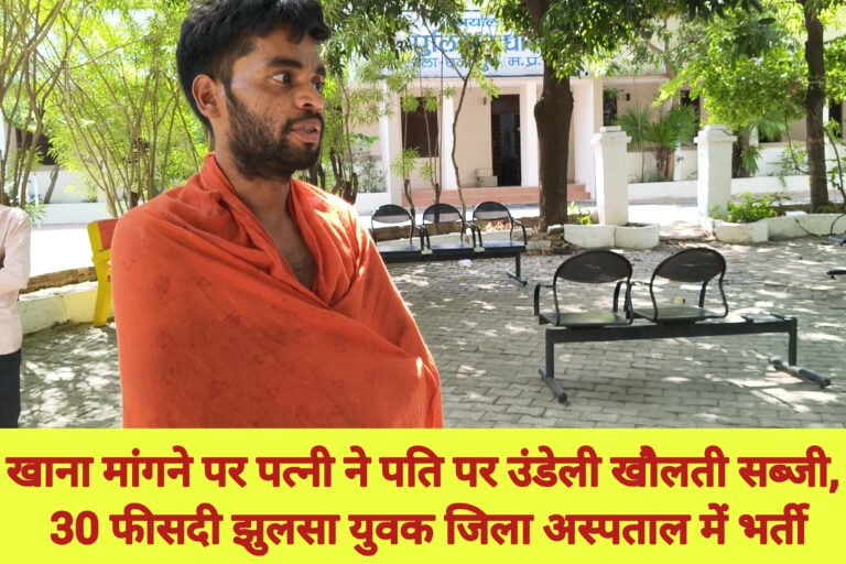खाना मांगने पर पत्नी ने पति पर उंडेली खौलती सब्जी, 30 फीसदी झुलसा युवक जिला अस्पताल में भर्ती