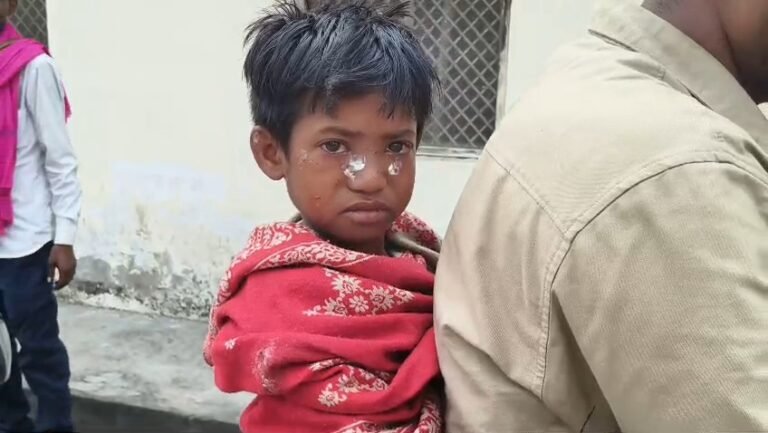 छतरपुर: स्कूल में जिंदा बम फटा, दो मासूम छात्र गंभीर घायल; बारातियों पर लापरवाही के आरोप